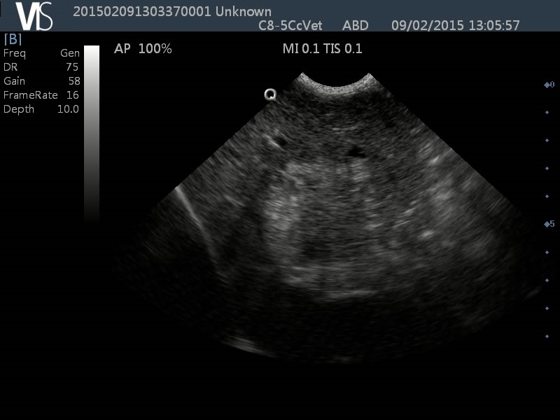 Liver Ultrasound